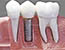 Dentisterie restauratrice